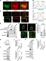 Paxillin Antibody in Western Blot, Immunoprecipitation (WB, IP)