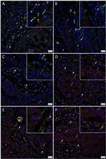 SOX2 Antibody in Immunohistochemistry (IHC)