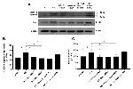 FIS1 Antibody in Western Blot (WB)