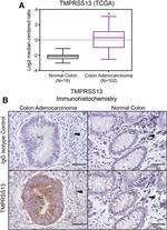 TMPRSS13 Antibody in Immunohistochemistry (IHC)