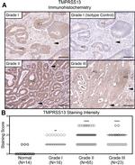 TMPRSS13 Antibody in Immunohistochemistry (IHC)