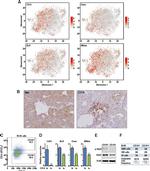 CD14 Antibody in Immunohistochemistry (IHC)