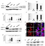 Glutaminase Antibody in Western Blot, Immunocytochemistry (WB, ICC/IF)