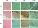 GLUT1 Antibody in Immunohistochemistry (IHC)