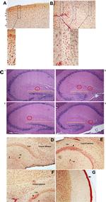 TSPO Antibody in Immunohistochemistry (IHC)