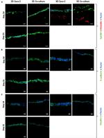 Claudin 1 Antibody in Immunohistochemistry, Immunocytochemistry (IHC, ICC/IF)