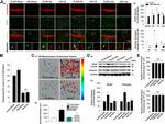 Aromatase Antibody in Immunohistochemistry, Immunocytochemistry (IHC, ICC/IF)