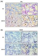 RAGE Antibody in Immunohistochemistry (IHC)