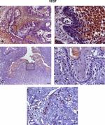 VEGF Antibody in Immunohistochemistry (IHC)