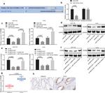 HOXB8 Antibody in Immunohistochemistry (IHC)
