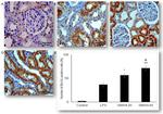 Bcl-xL Antibody in Immunohistochemistry (IHC)