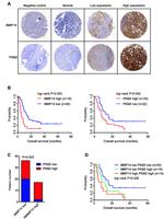 MMP14 Antibody in Immunohistochemistry (IHC)