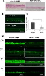TGM1 Antibody in Immunocytochemistry (ICC/IF)