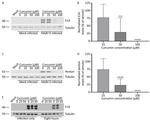 Adenovirus Type 5 Antibody in Western Blot (WB)
