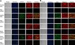 Biglycan Antibody in Immunohistochemistry, Immunocytochemistry (IHC, ICC/IF)