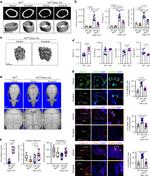 Phospho-MEKK2 (Ser520) Antibody in Immunohistochemistry (IHC)