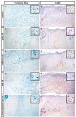 CD68 Antibody in Immunohistochemistry (IHC)