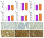 Progesterone Receptor Antibody in Immunohistochemistry (IHC)