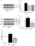 alpha-ENaC Antibody in Western Blot (WB)