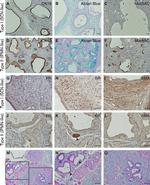 MUC5AC Antibody in Immunohistochemistry (IHC)