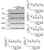 Phospho-CK2 alpha-1 (Tyr255) Antibody in Western Blot (WB)