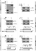 FAM47E Antibody in Western Blot (WB)