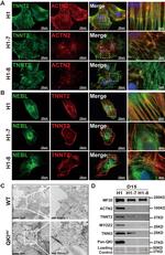 NEBL Antibody in Immunocytochemistry (ICC/IF)
