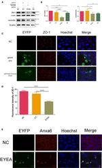 Annexin A6 Antibody in Immunocytochemistry (ICC/IF)