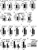 Phospho-AMPK alpha-1,2 (Thr172) Antibody in Western Blot (WB)