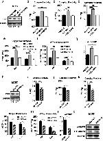 AMPK alpha-2 Antibody in Western Blot (WB)