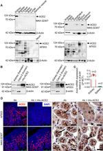 ACE2 Antibody in Western Blot, Immunohistochemistry (WB, IHC)
