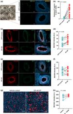 MUC5AC Antibody in Immunocytochemistry (ICC/IF)