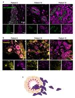 MEF2C Antibody in Immunohistochemistry (IHC)