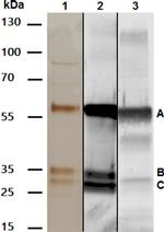 METTL7B Antibody in Western Blot (WB)