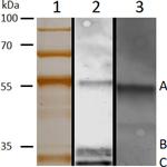 METTL7B Antibody in Western Blot (WB)