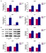 RORA Antibody in Western Blot (WB)