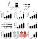 RORA Antibody in Western Blot (WB)