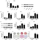 RORA Antibody in Western Blot (WB)
