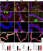 GFAP Antibody in Immunohistochemistry (IHC)