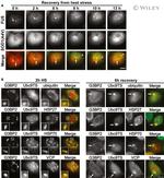 VCP Antibody in Immunocytochemistry (ICC/IF)