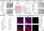 E-cadherin Antibody in Immunohistochemistry (IHC)