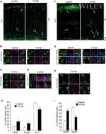 GFP Antibody in Immunocytochemistry (ICC/IF)
