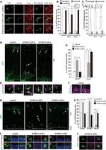 GFP Antibody in Immunocytochemistry (ICC/IF)