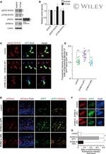 GFP Antibody in Immunocytochemistry (ICC/IF)