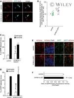 GFP Antibody in Immunocytochemistry (ICC/IF)