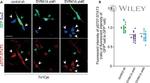 GFP Antibody in Immunocytochemistry (ICC/IF)