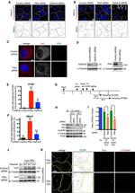Myc Tag Antibody in Immunocytochemistry (ICC/IF)