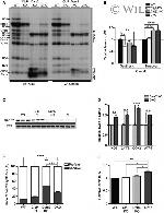 MTCO1 Antibody in Western Blot (WB)