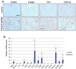CD45 Antibody in Immunohistochemistry (IHC)