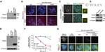 GFP Antibody in Immunocytochemistry (ICC/IF)